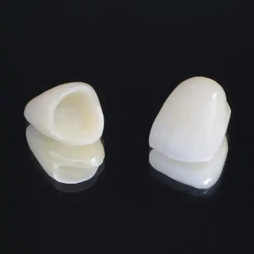 オールセラミッククラウン