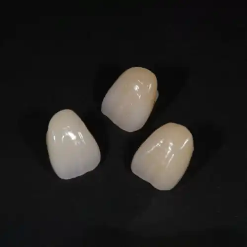 オールジルコニアクラウン