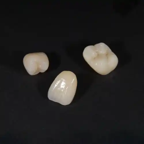 ジルコニアセラミッククラウン