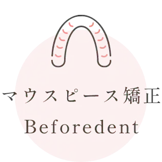 マウスピース矯正 Beforedent